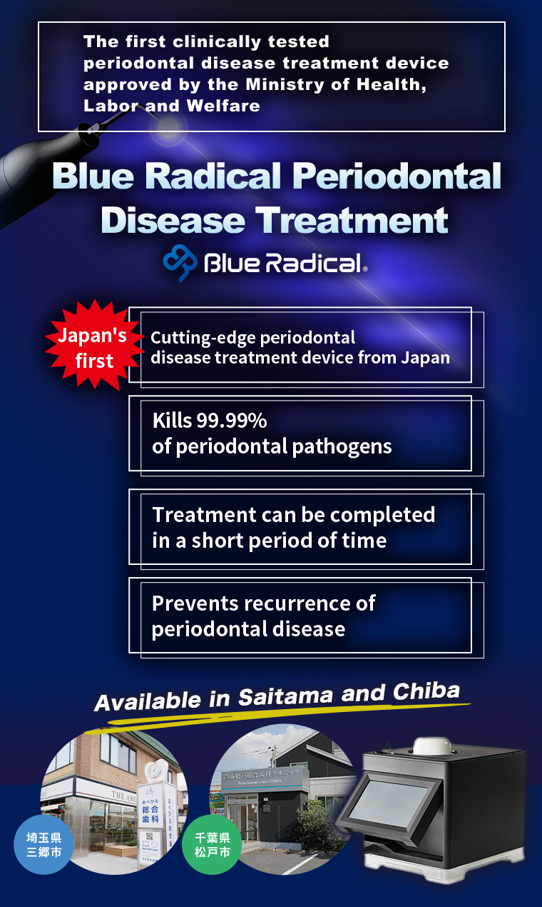 【厚生労働省認可の治験済み初歯周病治療機器】「ブルーラジカル歯周病治療」が埼玉・千葉で受けられます【日本発!最先端の歯周病治療機器】【歯周病原菌99.99%殺菌】【短期間で治療可】【歯周病の再発防止】